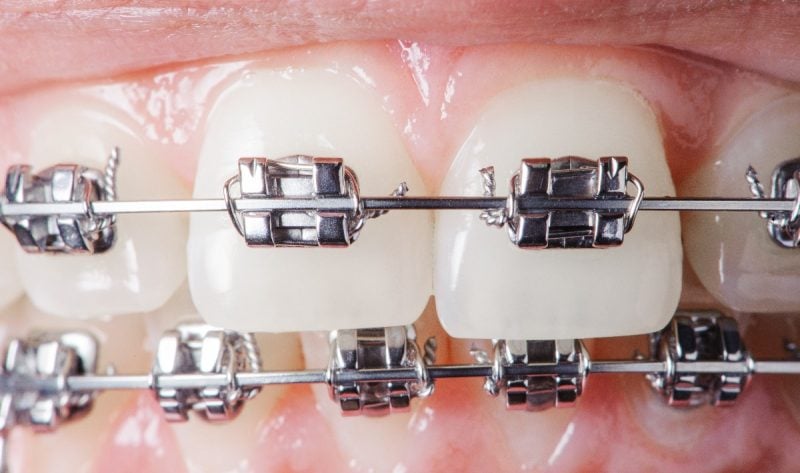 orthodontist marketing