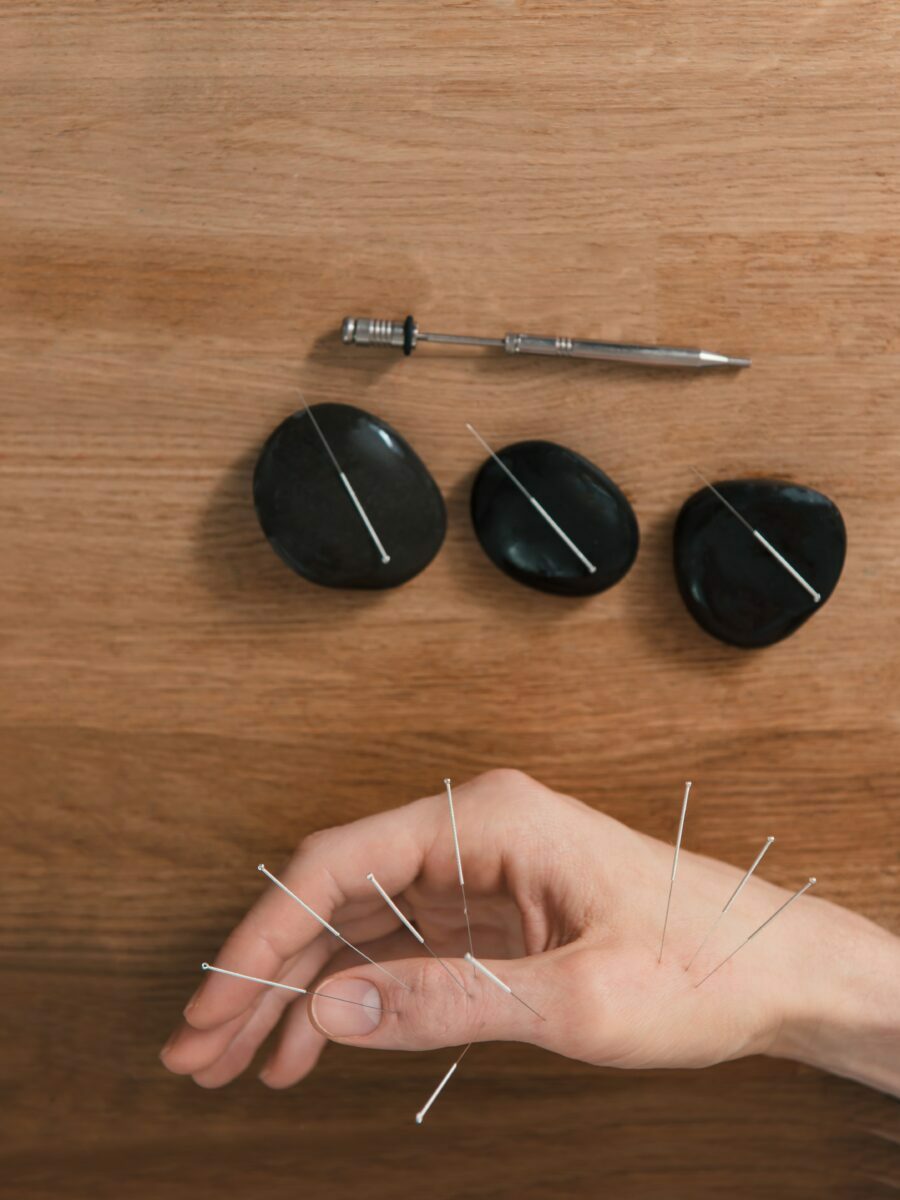 social media marketing for acupuncture clinics