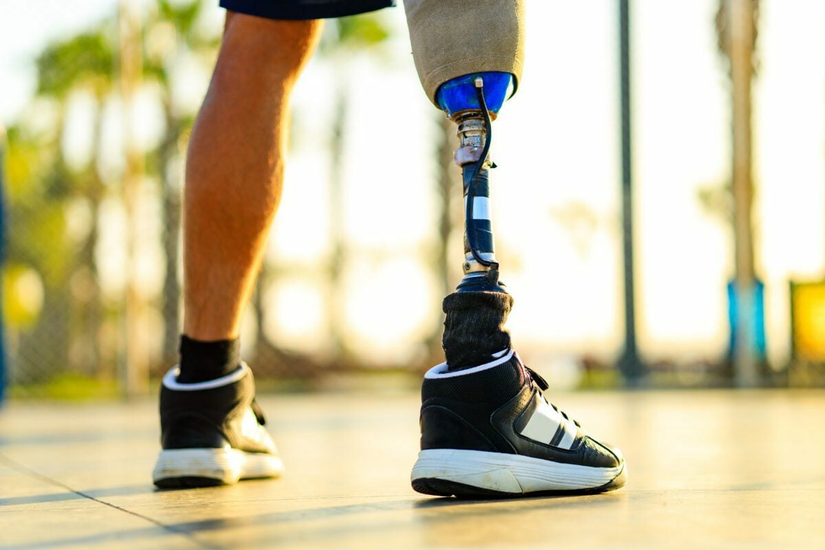 website creation for prosthetics