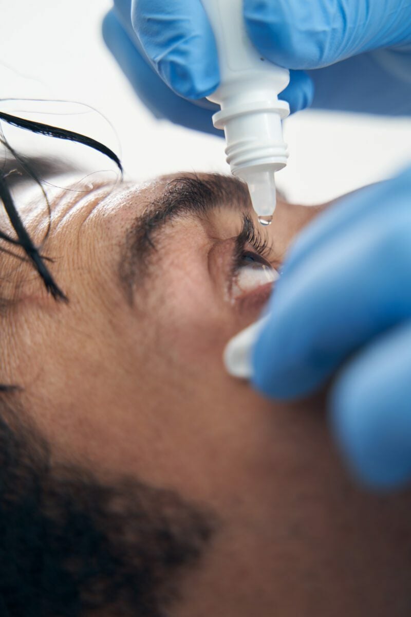 marketing for optician doctor